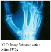 xray image enhanced